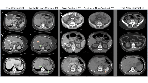 Examples of CT scans with different contrasts