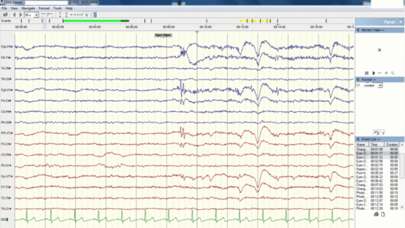 Electroencephalogram (EEG) and data related to contrastive predictive coding (CPC)
